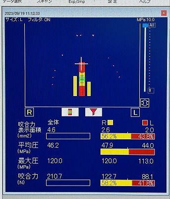 プレスケール